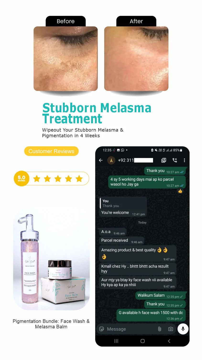 Face Balm For Melasma