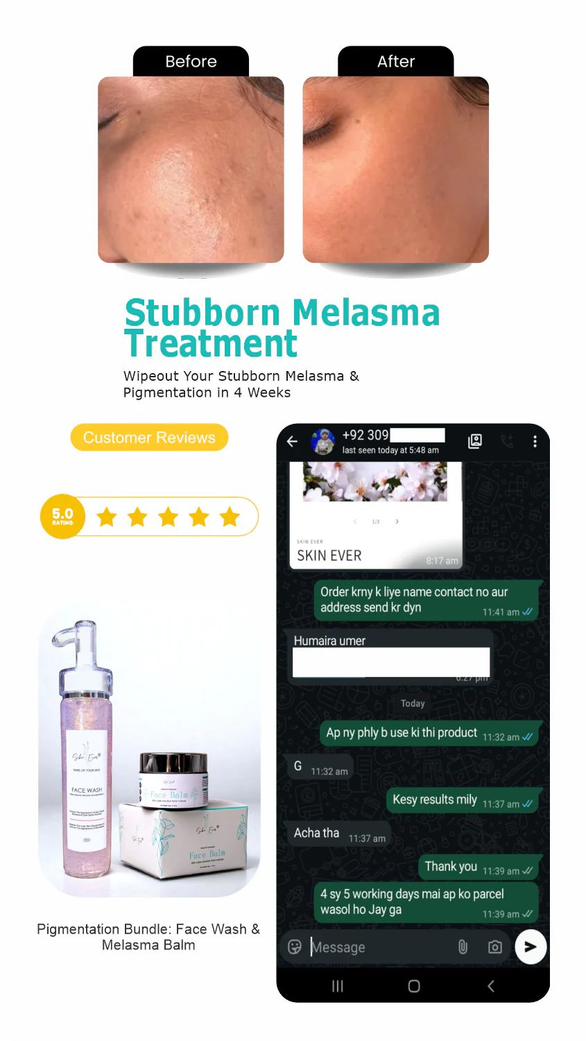 Face Balm For Melasma