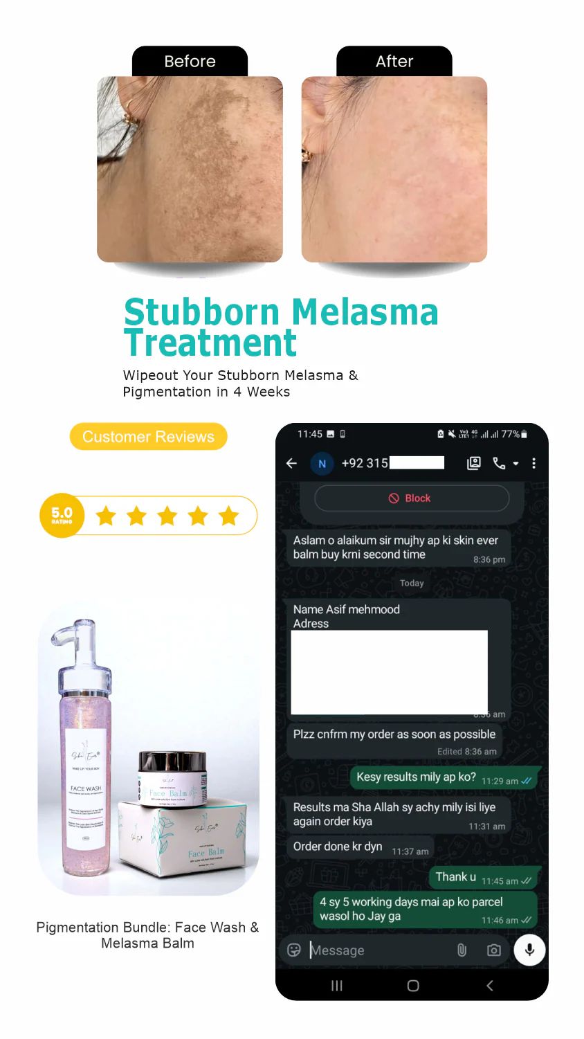 Face Balm For Melasma
